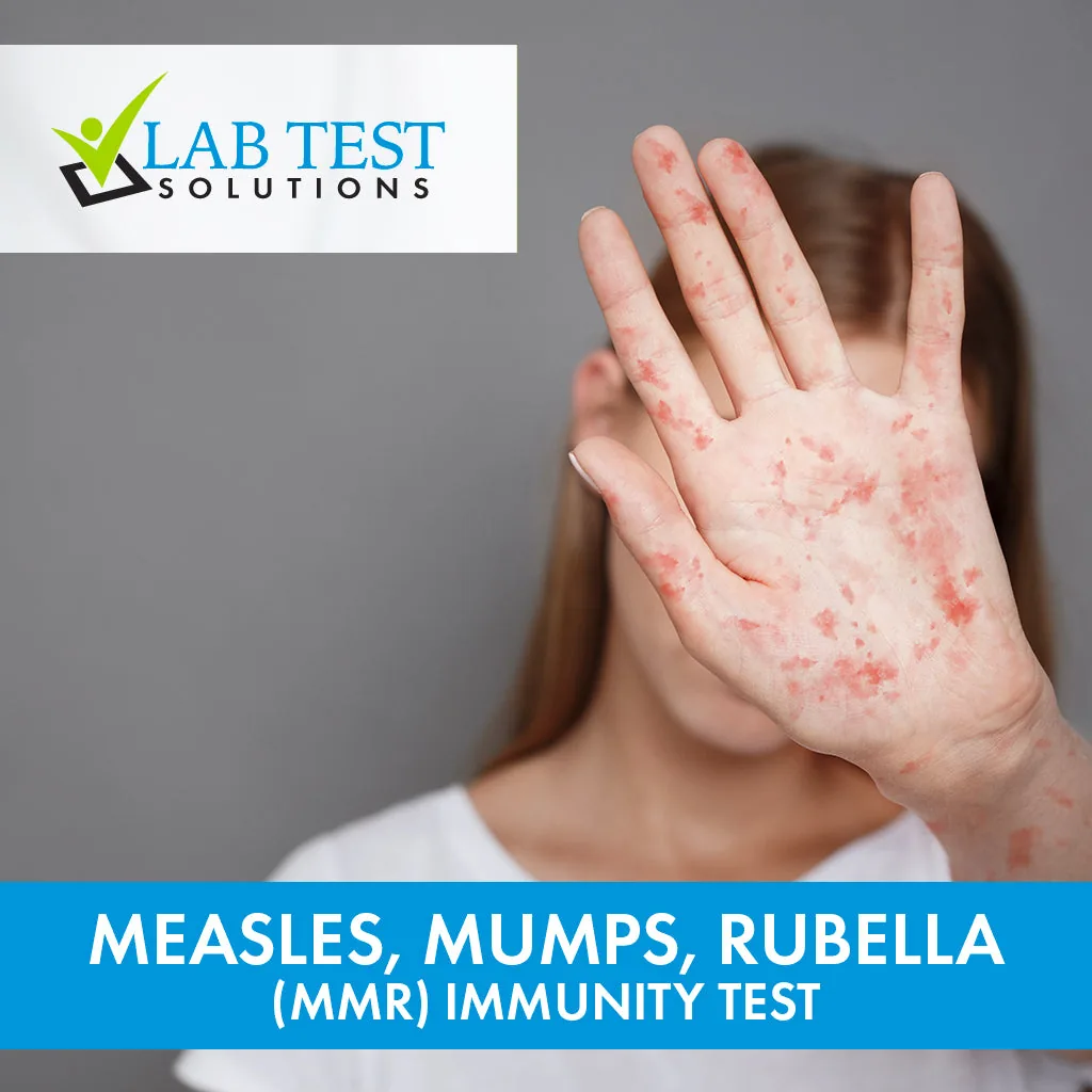 MMR Immunity Profile (Measles, Mumps, Rubella Antibody Test)